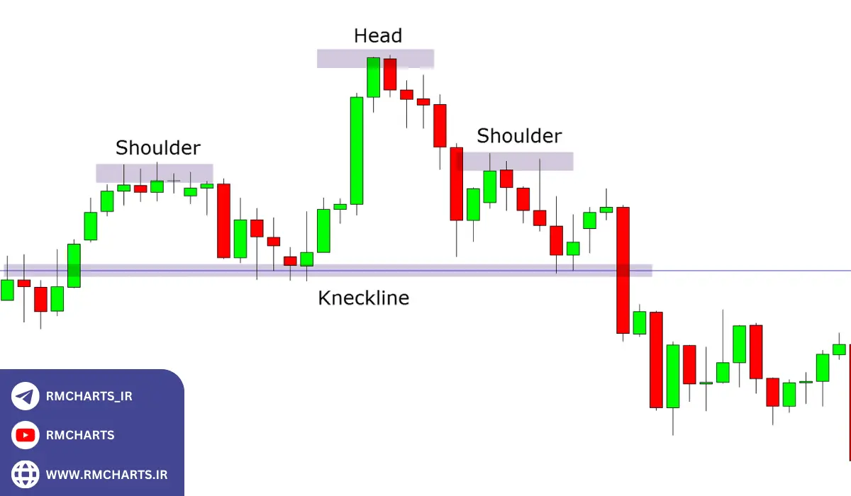 اجزای تشکیل دهنده الگو‌های سر و شانه