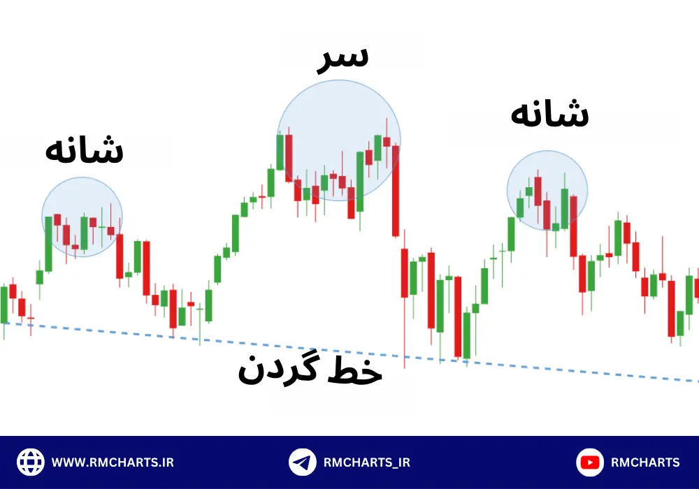 الگوی سر و شانه