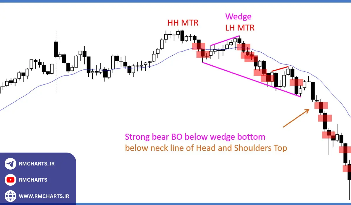 مزایا و معایب روش ال بروکس