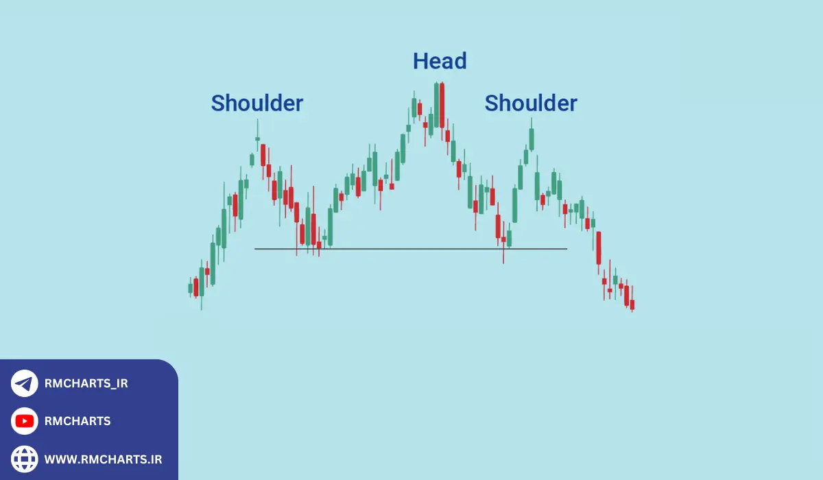 الگوی سر و شانه
